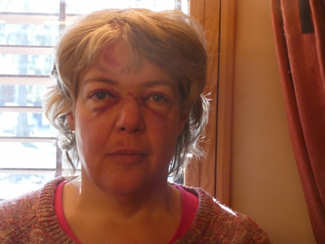 1. Tag danach, es geht